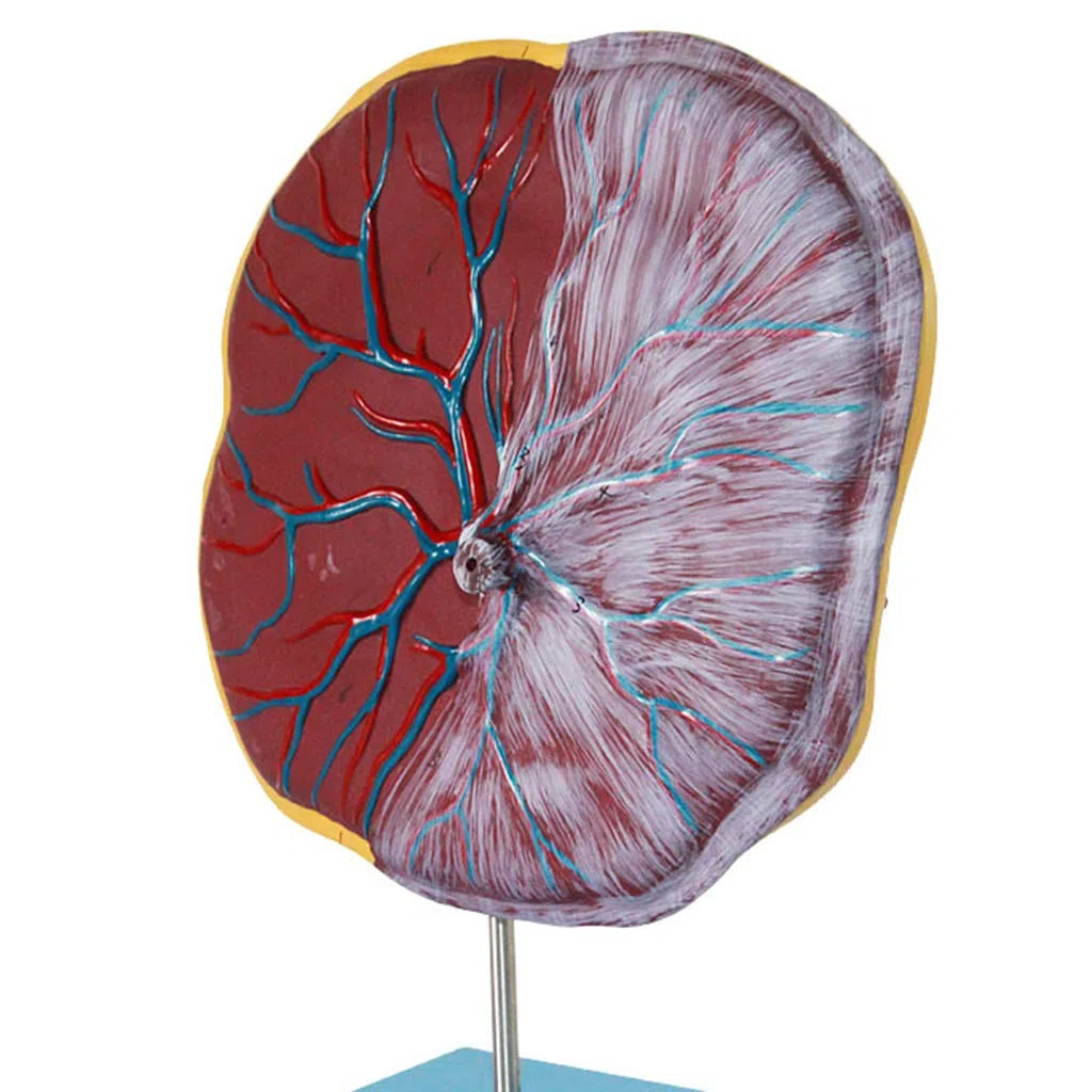 Plazenta- Und Nabelschnurmodell, Medizinische Geräte, Modell Der Menschlichen Anatomie, Medizinisches Lehrmittel, Medizinische Modelle Und Lehrmaterialien