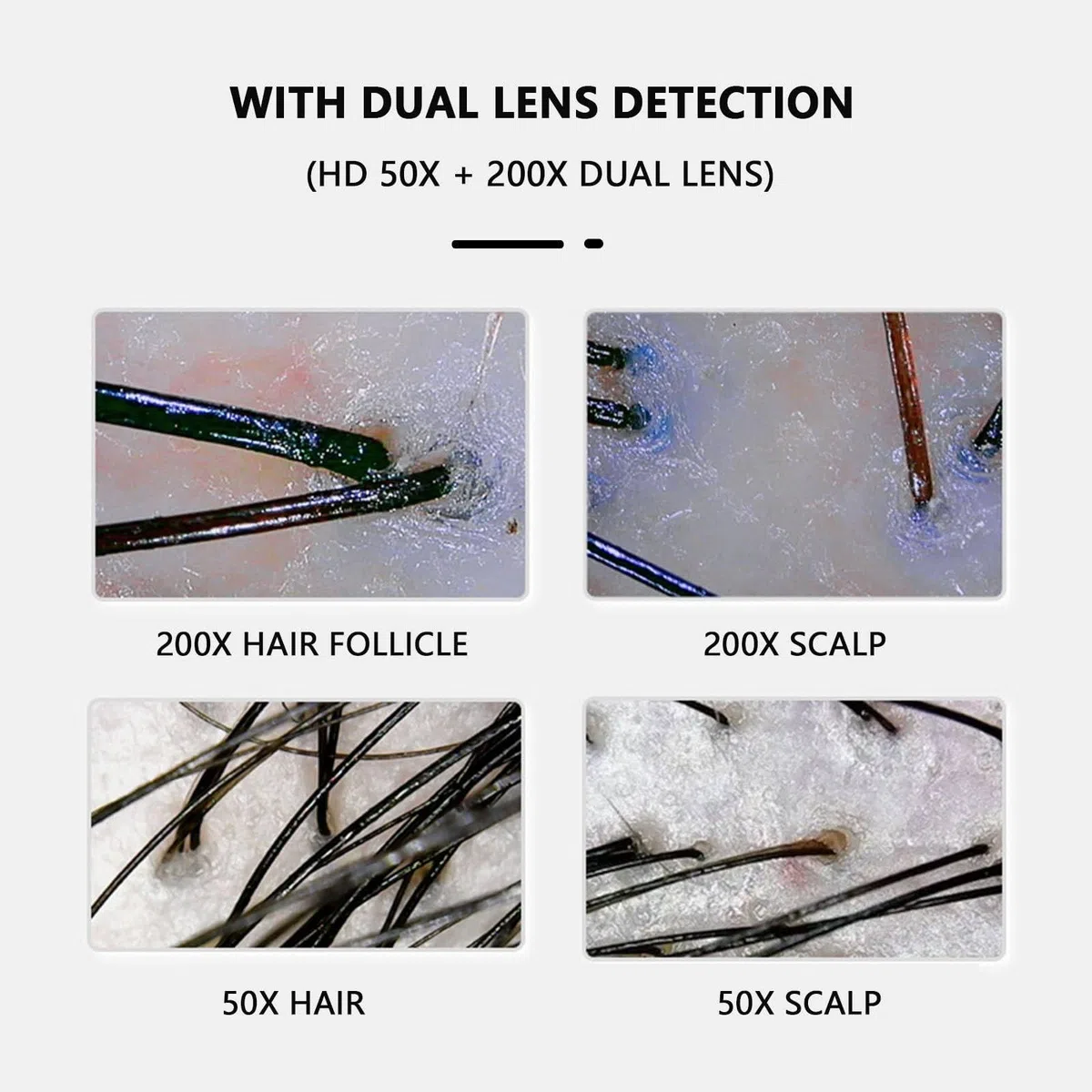 Hauthaaranalysator, 27,9 cm HD LCD Sn 50X/200X Lupe, professionelles Analysegerät, All-in-One-Gerät, Follikelanalysator, Detektor für den Heimsalon, d (d)
