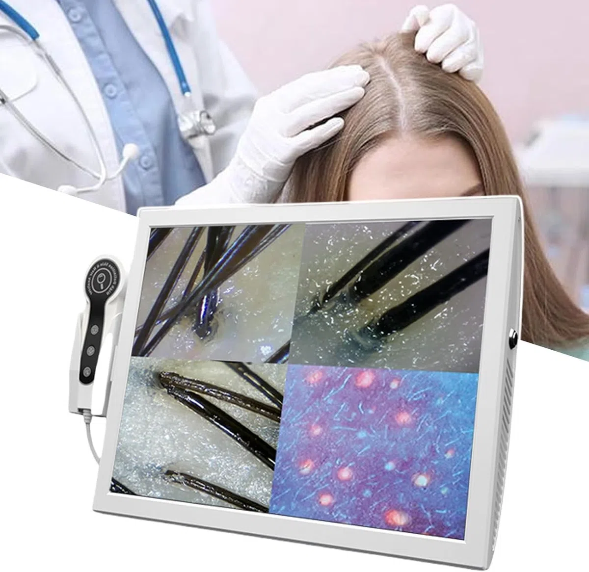 Haut-, Haar- und Kopfhautdetektor, Hautdiagnose-Haaranalysator, 15 Zoll 50X 200X Linse Kopfhaut-Haarfollikel-Hauthaardetektor-Analysegerät