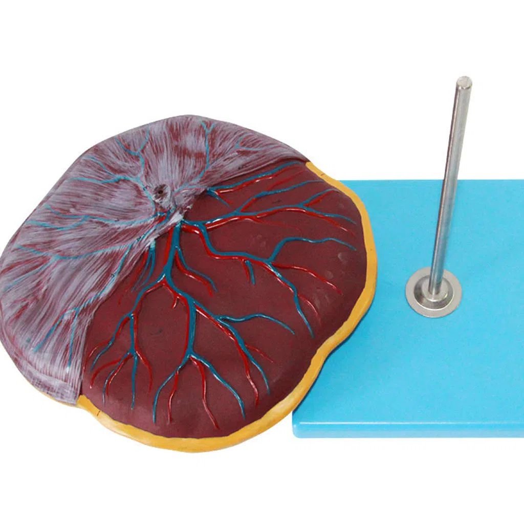 Plazenta- Und Nabelschnurmodell, Medizinische Geräte, Modell Der Menschlichen Anatomie, Medizinisches Lehrmittel, Medizinische Modelle Und Lehrmaterialien