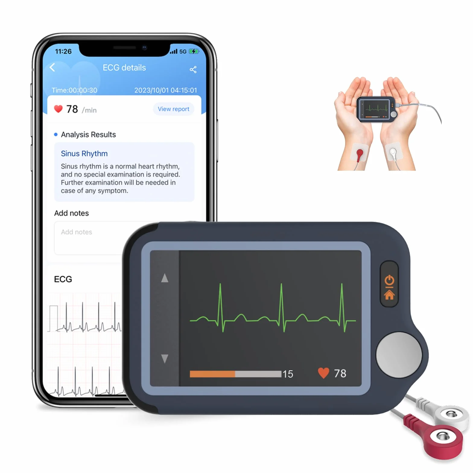 CheckMe Plus EKG Gerät für Zuhause, KI-Analysefunktion, 30s/ 60s/5min Messzeit für Smartphone und PC, Persönlicher Tragbarer Herzgesundheits-Tracker, Großbild-Echtzeitanzeige