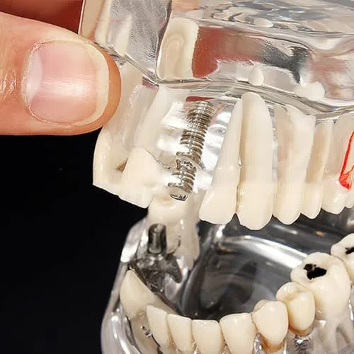 Zahnarztmodell – Transparente Anatomie-Replik des menschlichen Körpers für pädagogische Verwendung im Zahnarztpraxis
