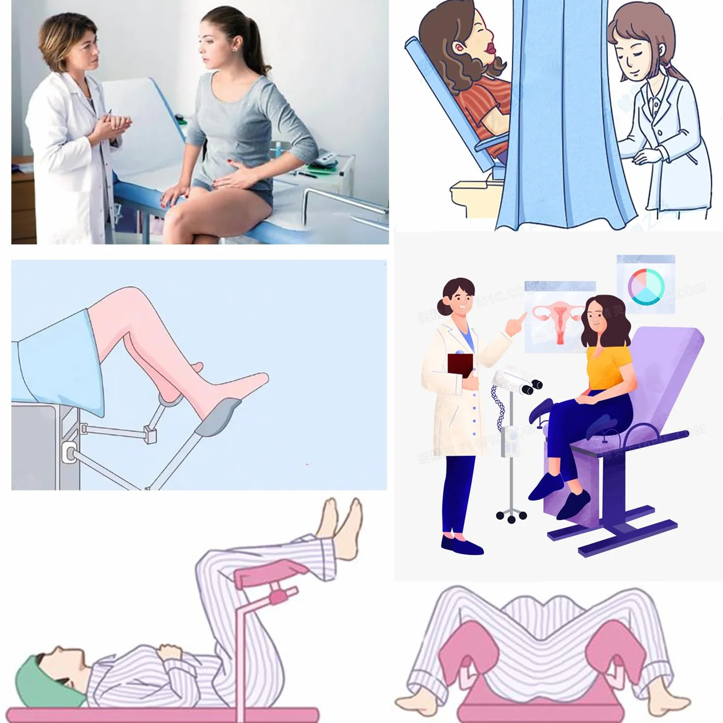 Gynäkologischer Untersuchungstisch - Klappbett für Krankenhaus & Schönheitssalon - Chirurgische Spülung & Frauen Pflegegeräte - Untersuchungsstuhl - Gynäkologisches Gerät