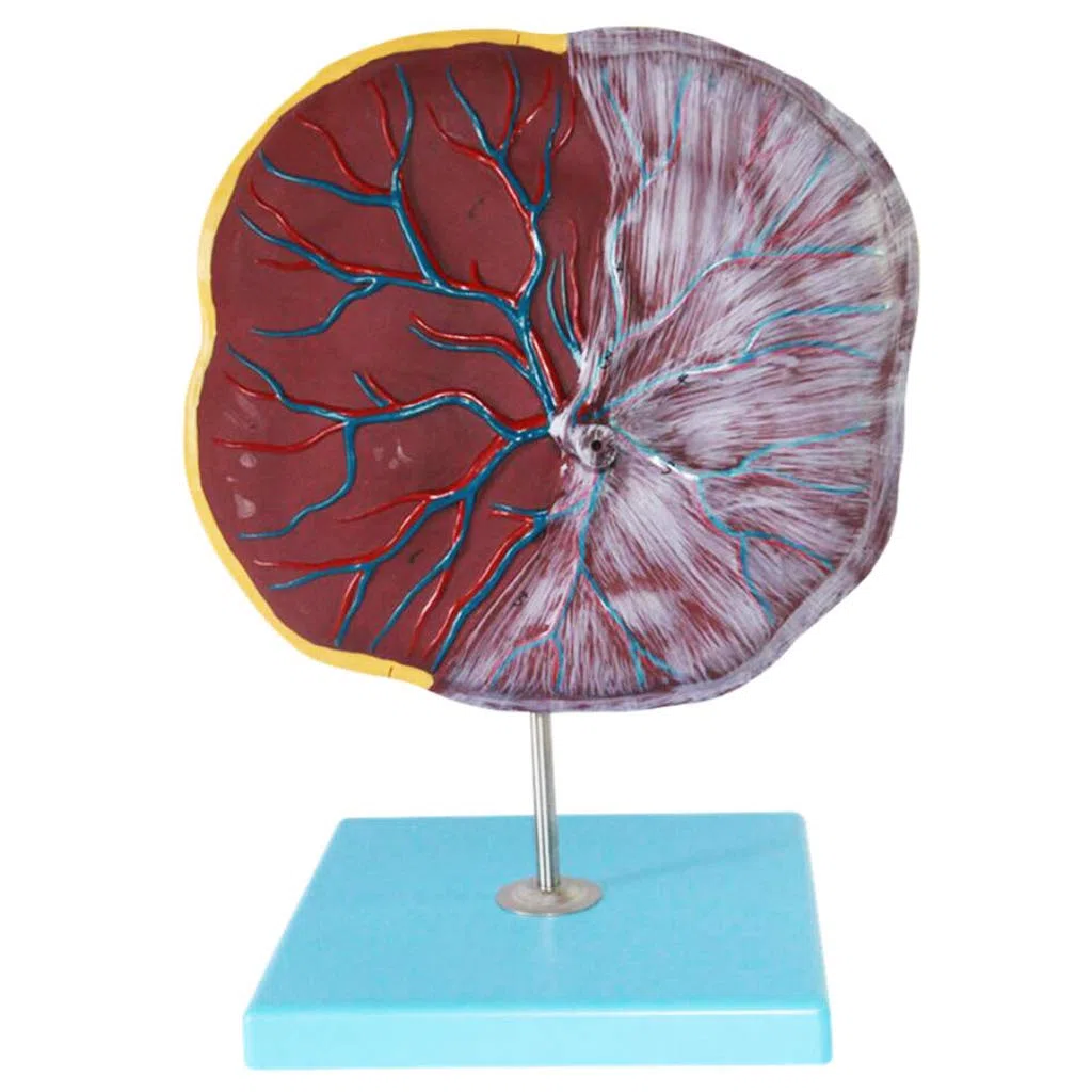Plazenta- Und Nabelschnurmodell, Medizinische Geräte, Modell Der Menschlichen Anatomie, Medizinisches Lehrmittel, Medizinische Modelle Und Lehrmaterialien